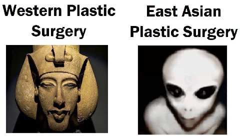 Western Plastic East Asian Surgery Plastic Surgery