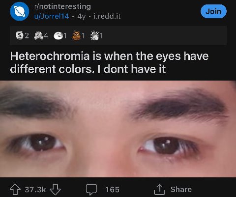 r/notinteresting u/Jorrel14 i.redd.it 92 24 Heterochromia is when the eyes have different colors. dont have it 4} (2 165 Share