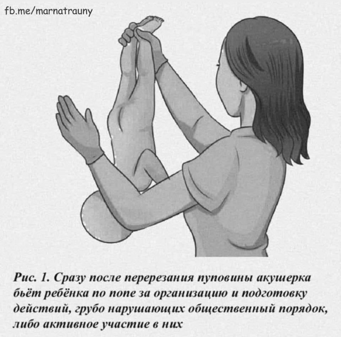 fb.me/marnatrauny A Рис. 1. Сразу после перерезания пуповины акушерка бьёт ребёнка по попе за организацию и подготовку действий, грубо нарушающих общественный порядок, либо активное участие в них