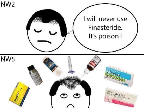 will never use Finasteride. It's poison!