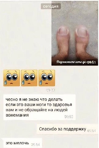 My, Подскажите што 09:53 чесно я не знаю что делать если это ваши ноги то здаровья вам и не обращайте на людей ввнемания 09:53 Спасибо за поддержку это мелочь
