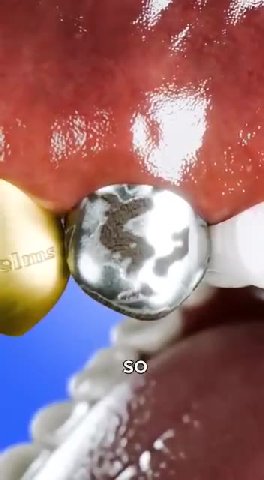 SO