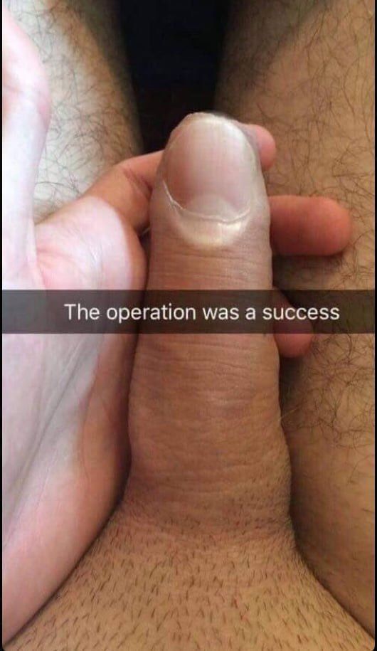Тре operation was a success