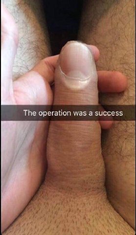 Тре operation was a success