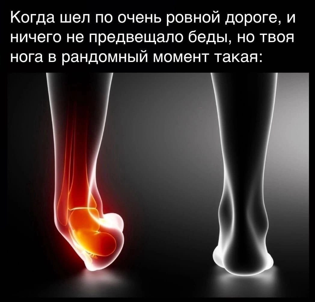 Когда шел по очень ровной дороге, и ничего не предвещало беды, но твоя нога в рандомный момент такая: