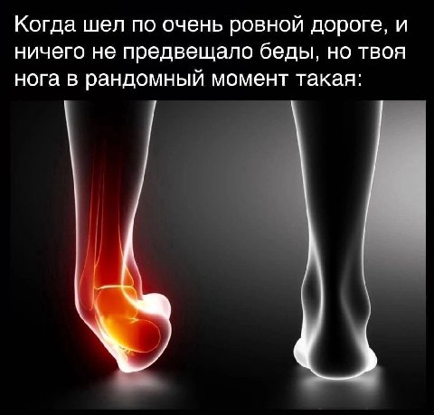 Когда шел по очень ровной дороге, и ничего не предвещало беды, но твоя нога в рандомный момент такая: