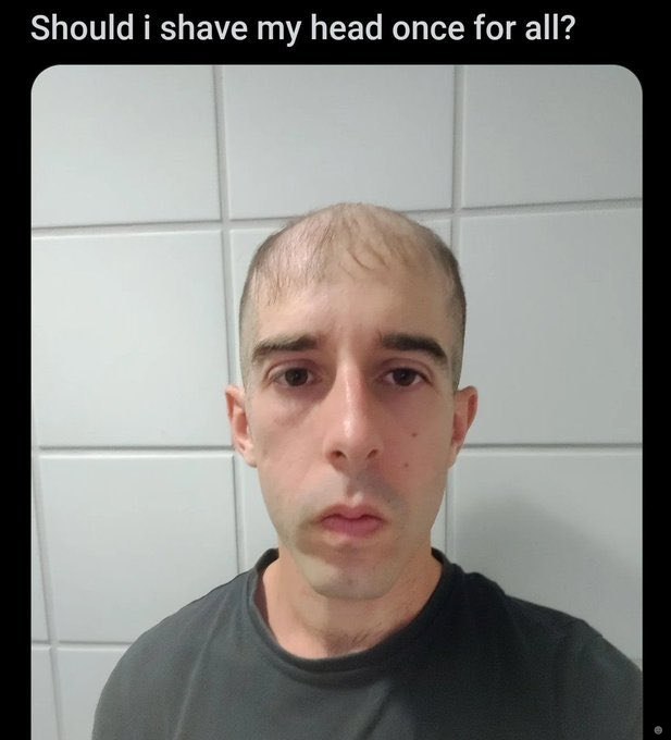 Should i shave my head once for all?
