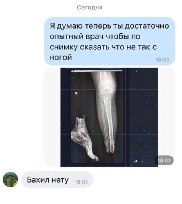 Я думаю теперь ты достаточно опытный врач чтобы по снимку сказать что не так с ногой Бахил нету
