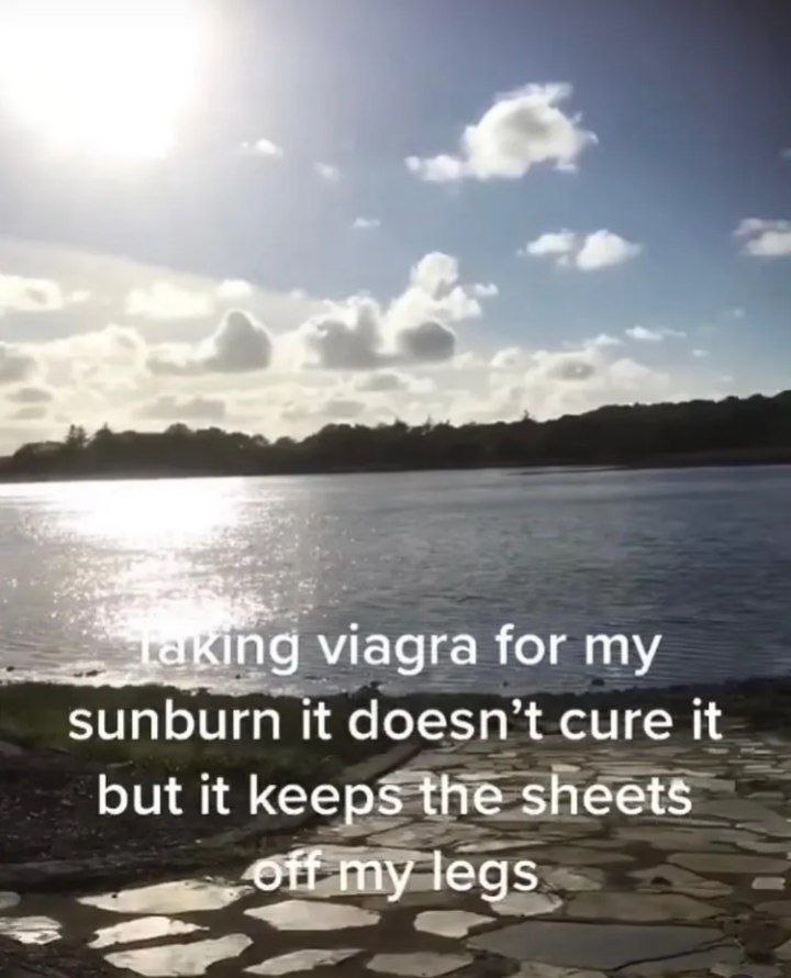 viagra for my sunburn it doesn’t cure it but it keeps the sheets Off my legs