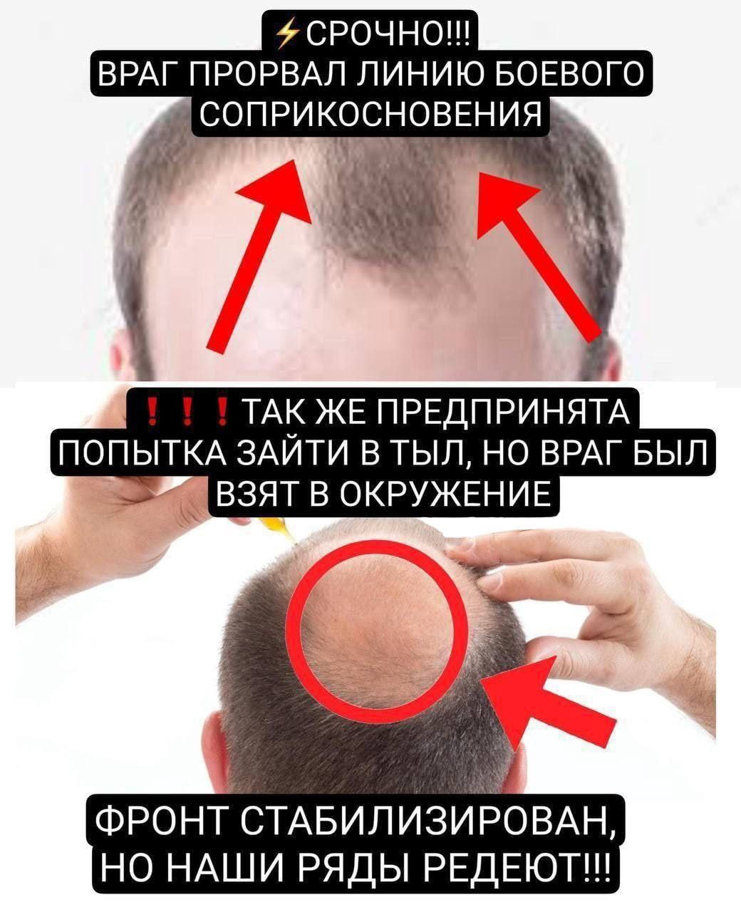 СРОЧНО!! ВРАГ ПРОРВАЛ ЛИНИЮ БОЕВОГО СОПРИКОСНОВЕНИЯ a 7 i TAK ЖЕ ПРЕДПРИНЯТА ПОПЫТКА ЗАЙТИ ВТЫЛ, НО ВРАГ БЫЛ ВЗЯТ В ОКРУЖЕНИЕ i А ФРОНТ СТАБИЛИЗИРОВАН, НО НАШИ РЯДЫ РЕДЕЮТ!!