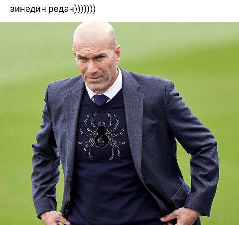 зинедин редан)))))))