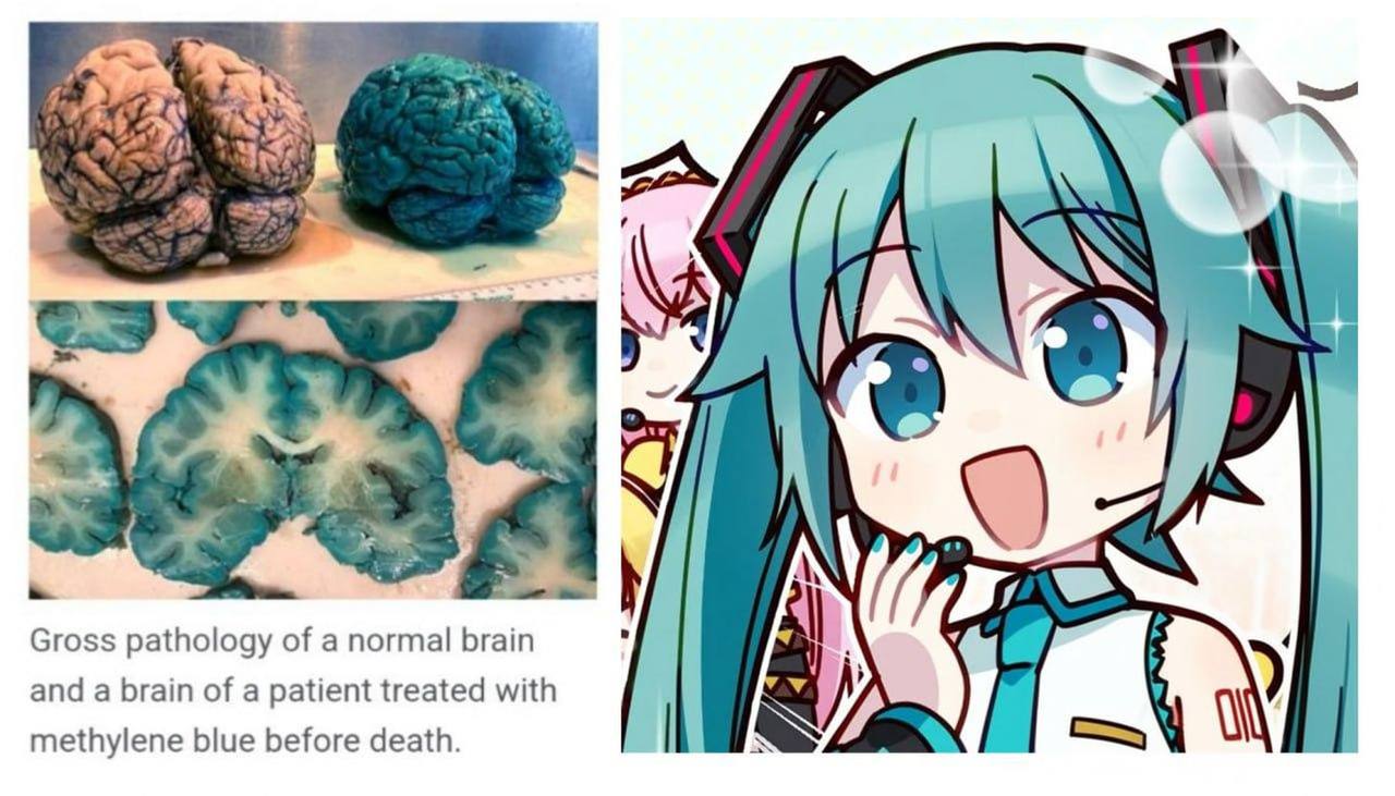 bey aN 1 У 4 Я 4 Gross pathology of а normal brain and a brain of а patient treated with methylene blue before death.