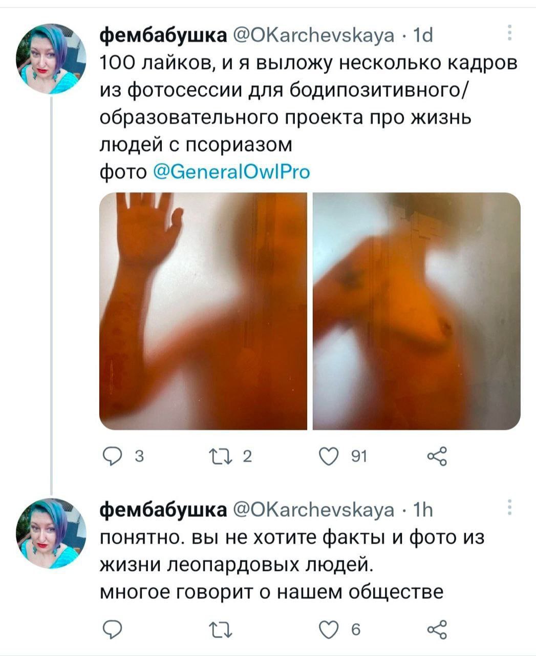 фембабушка @OKarchevskaya 100 лайков, и я выложу несколько кадров из фотосессии для бодипозитивного/ образовательного проекта про жизнь людеи с псориазом фото 2 91 фембабушка @OKarchevskaya понятно. в