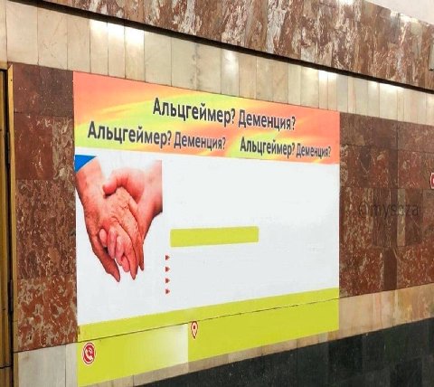 Альцгейм Деменция?