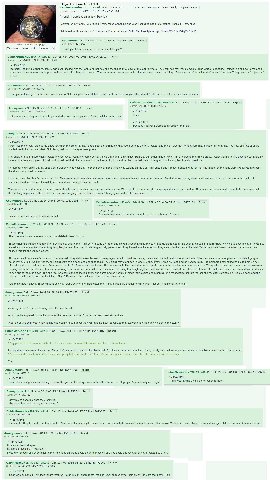 Original post was 17 Oct 2014 CabinMemories Sat 15 Nov 2014 01:17:54 No.15472512 View Веру Report Quoted >>15472849 >>15473481 >>15475635 Гол promised an update. Here it is confronted my family. We ta