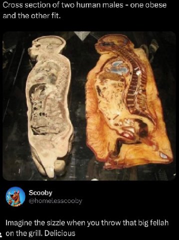 Cross section of two human males one obese and the other fit. Scooby @homelesscooby Imagine the sizzle when you throw that big fellah on the grill. Delicious