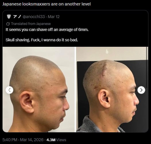 Japanese looksmaxxers are on another level @anocchi33 Mar 12 Translated from Japanese It seems you can shave off an average of Skull shaving. Fuck, wanna it so bad. “4 4 5:40 Mar 14, 2026 Views