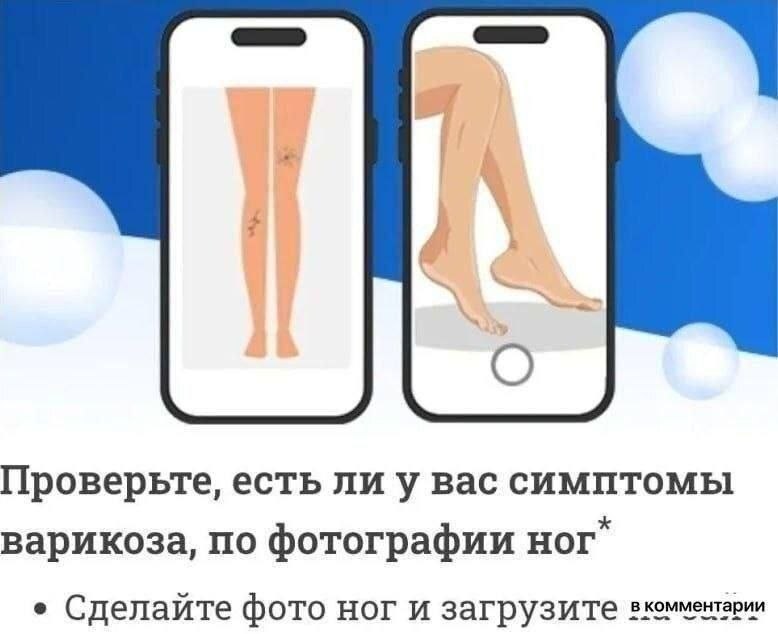 Проверьте, есть лиу вас симптомы варикоза, по фотографии Hor Сделайте фото ног и загрузите вкомментарии
