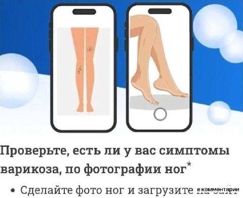 Проверьте, есть лиу вас симптомы варикоза, по фотографии Hor Сделайте фото ног и загрузите вкомментарии