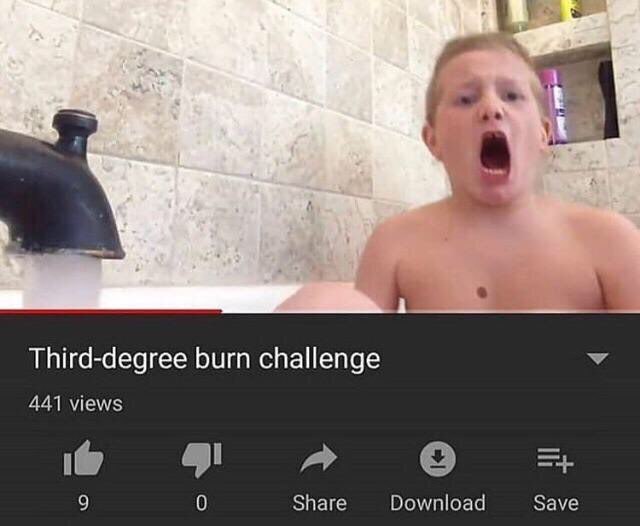 we 1 Third-degree burn challenge У 441 views A 9 0 Share Download Save