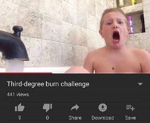 we 1 Third-degree burn challenge У 441 views A 9 0 Share Download Save