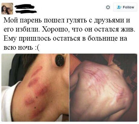 РОНО\ Мой парень пошел гулять с друзьями и его избили. Хорошо, что остался жив Ему пришлось остаться в больнице на всю ночь