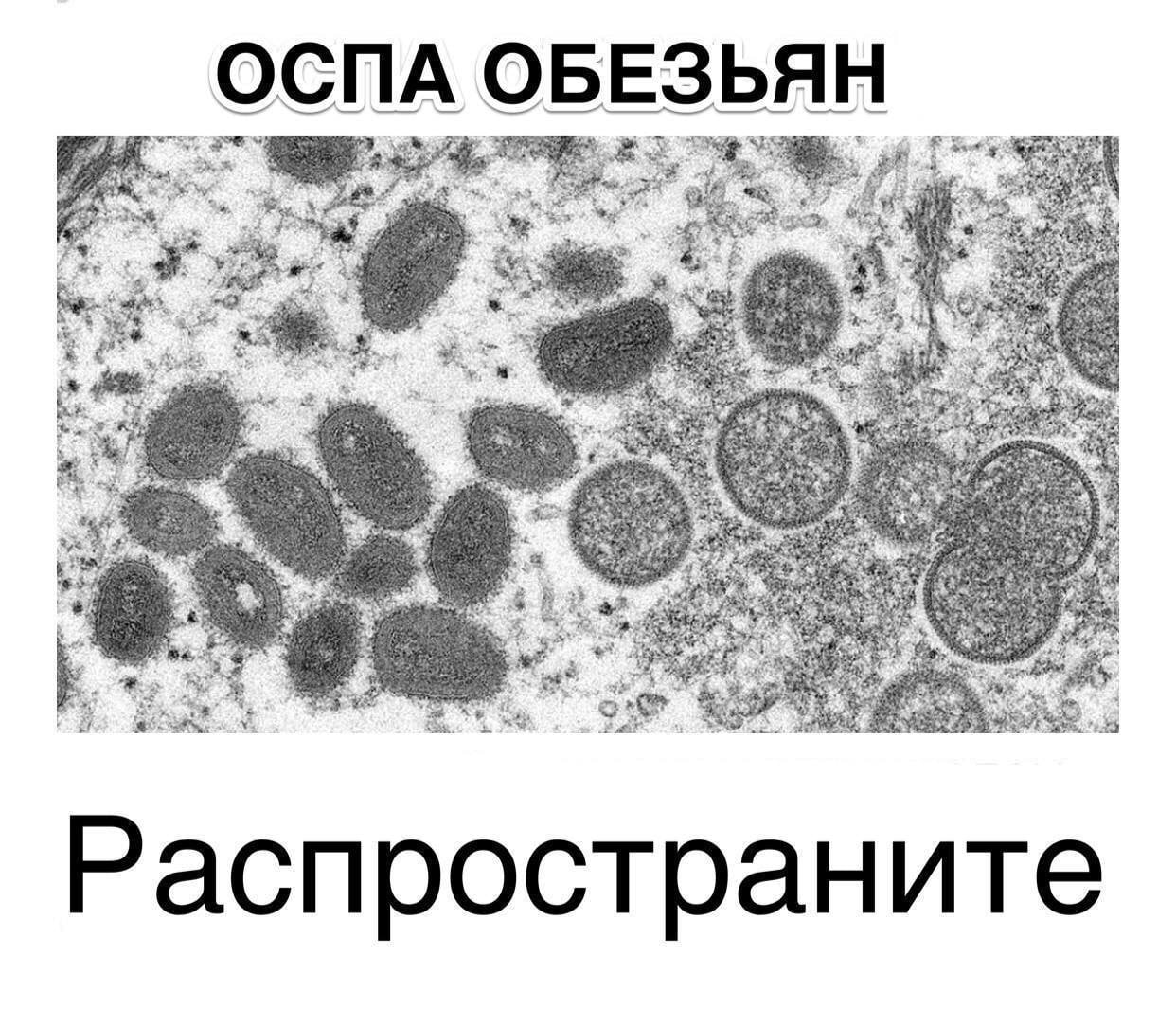 ОСПА ОБЕЗЬЯН ats 29 Распространите