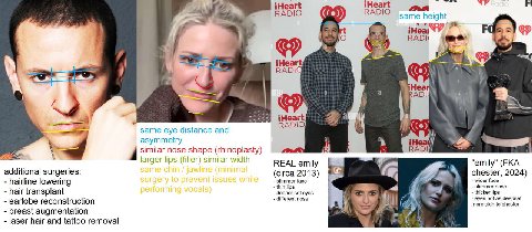 iHeart Неа RADIO height a 7 if iHeai а iHear a RADI wor у 7 a a РАС: a same eye distance and asymmetry iHez A 9 similar nose shape (rhinoplasty) larger lips (filler) similar width REAL emily "emily" (
