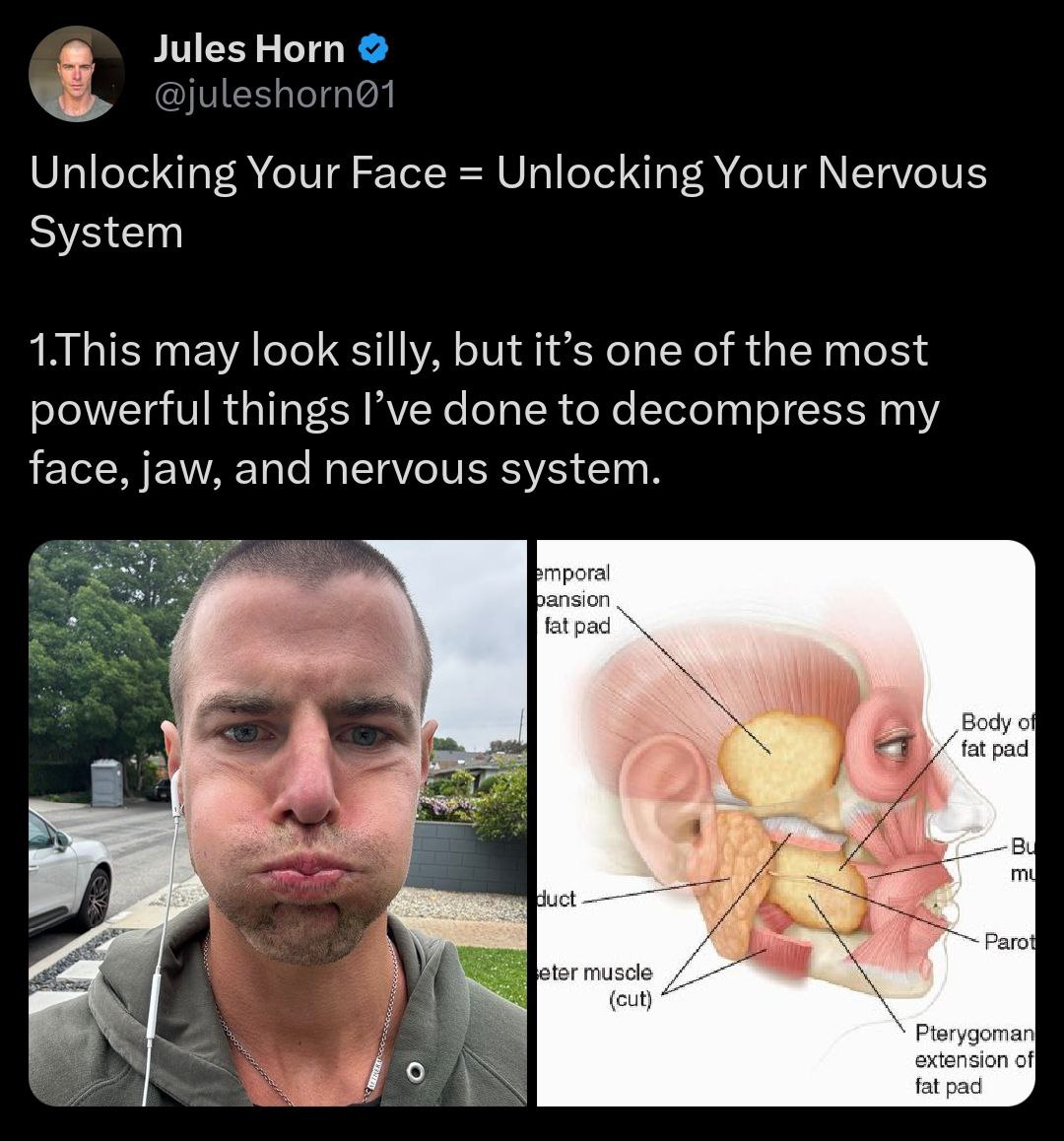 Unlocking Your Face Unlocking Your Nervous System 1.This may look silly, but it’s one of the most powerful things Гуе done to decompress my face, jaw, and nervous system. Bmporal fat pad Я Body с fat 