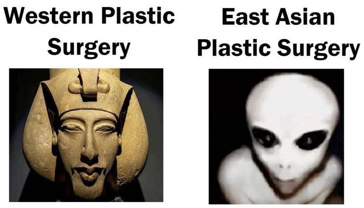 Western Plastic East Asian Surgery Plastic Surgery