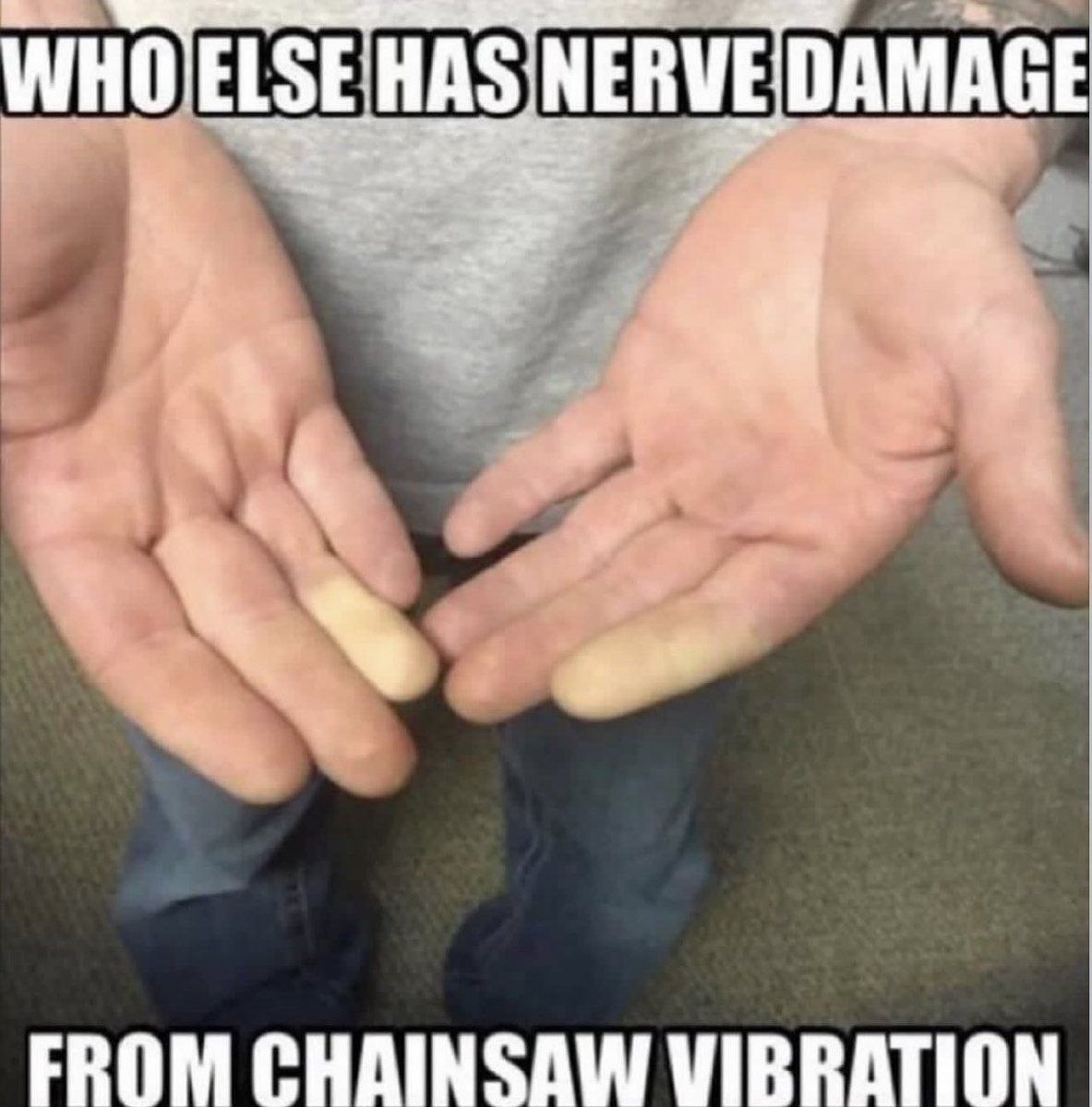 DAMAGE FROM CHAINSAW VIBRATION