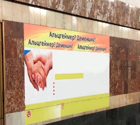 Альцгейм Деменция?