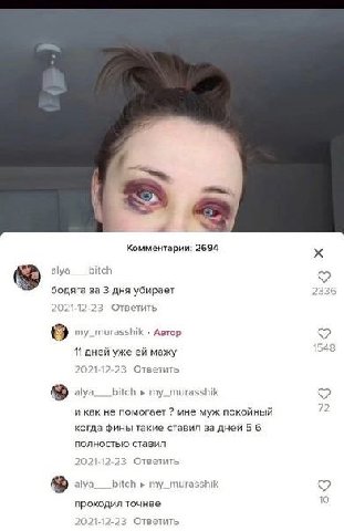 Комментарии: 2694 ауа bitch бодяга за 3 дня убирает Ответить my_murasshik Автор 548 11 дней уже мажу 021 Ответить alya bitch my_murasshik и как не помогает мне муж покойный когда фины такие ставил за 