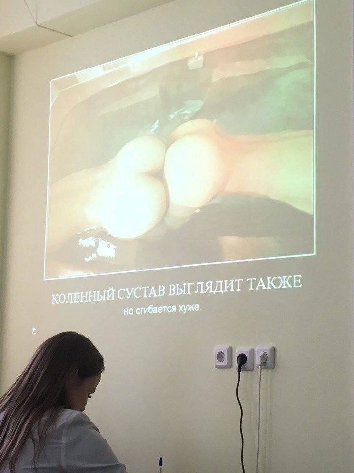 КОЛЕННЫЙ СУСТАВ ВЫГЛЯДИТ ТАКЖЕ но сгибается хуже.