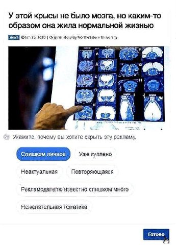 У этой крысы не было мозга, но каким-то образом она жила нормальной жизнью 25, 2020 Original story Northeastern University A "A В) 6 is и укажите, почему вы хотите скрыть эту рекламу. Слишком пичное У