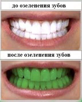 до озеленения зубов после озеленения зубов