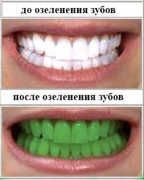 до озеленения зубов после озеленения зубов