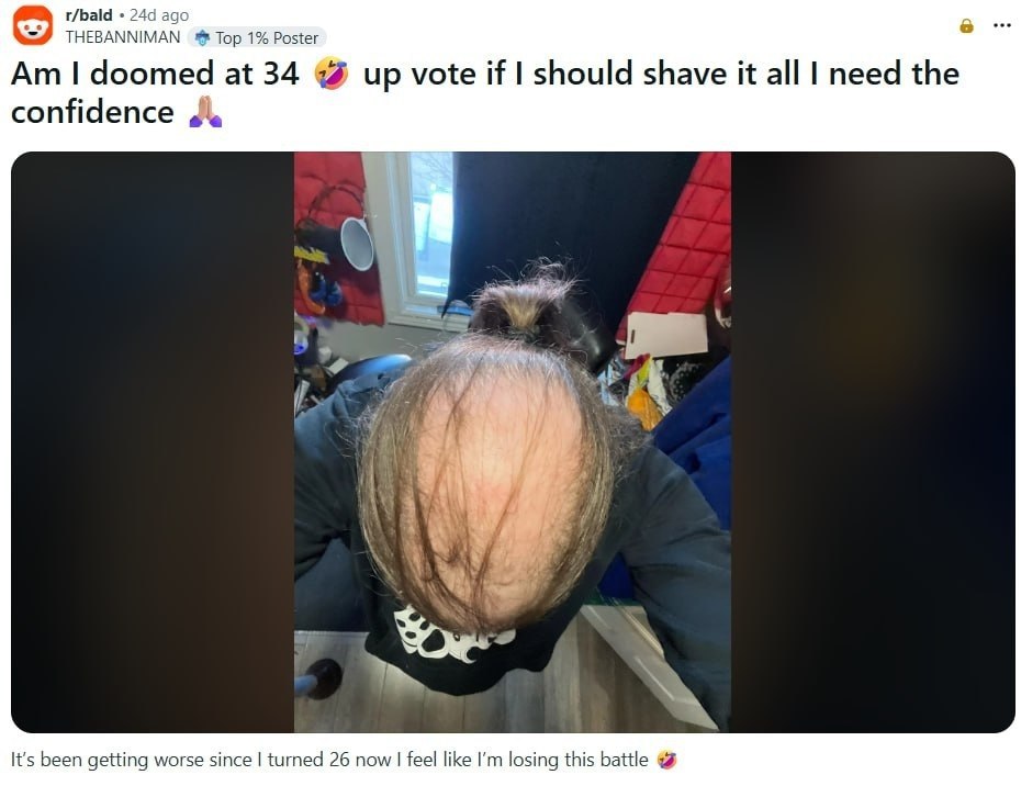 r/bald ago в THEBANNIMAN Тор 1% Poster doomed at 34 up vote if should shave it all need the confidence у и. К on я Wee We- It's been getting worse since turned 26 now feel like losing this battle