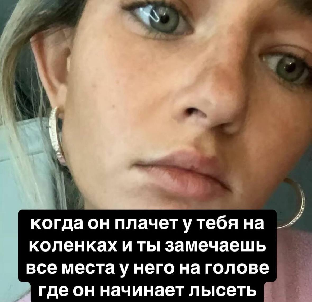 когда он плачет утебя на коленках и ты замечаешь все местау него на голове гдеон начинает лысеть