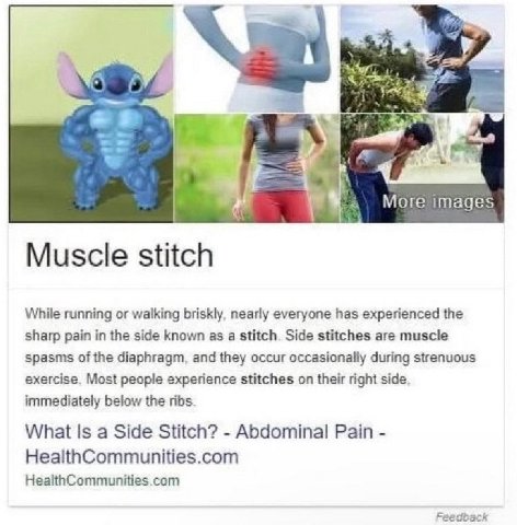 у 2% More images Muscle stitch While running or walking briskly, nearly everyone has experienced the sharp pain in the side known as a stitch. Side stitches are muscle spasms of the diaphragm, and the