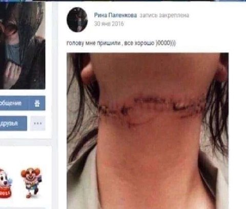 6 Рина Паленкова запу голову мне пришили все хорошо )0000))) 2