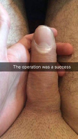 The operation was a success