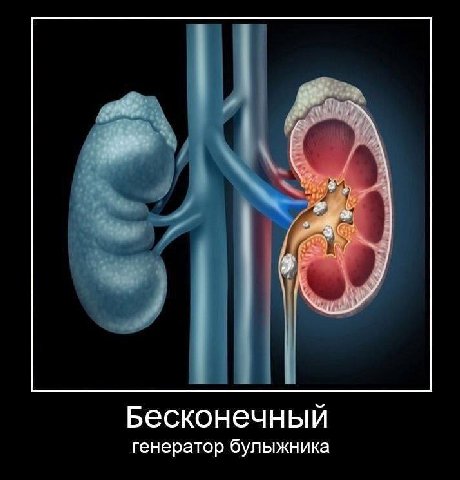 Бесконечный генератор булыжника