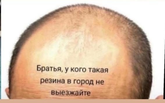 Братья, у кого такая В ород не выезжаите a