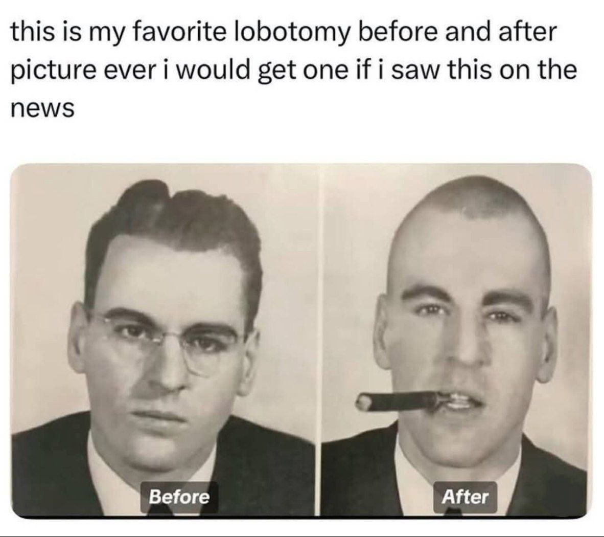 this is my favorite lobotomy before and after picture ever i would get one if i saw this on the news 3 Before After
