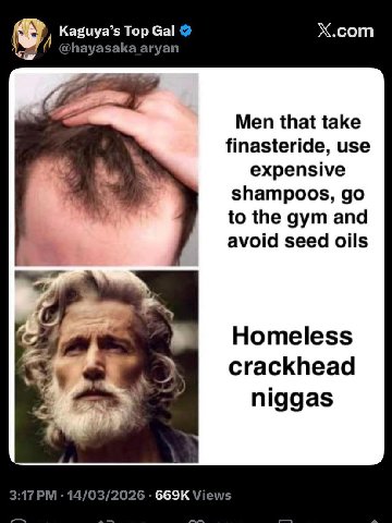 Kaguya’s Тор Gal X.com Men that take finasteride, use expensive shampoos, to the gym and avoid seed oils crackhead niggas 14/03/2026 Views
