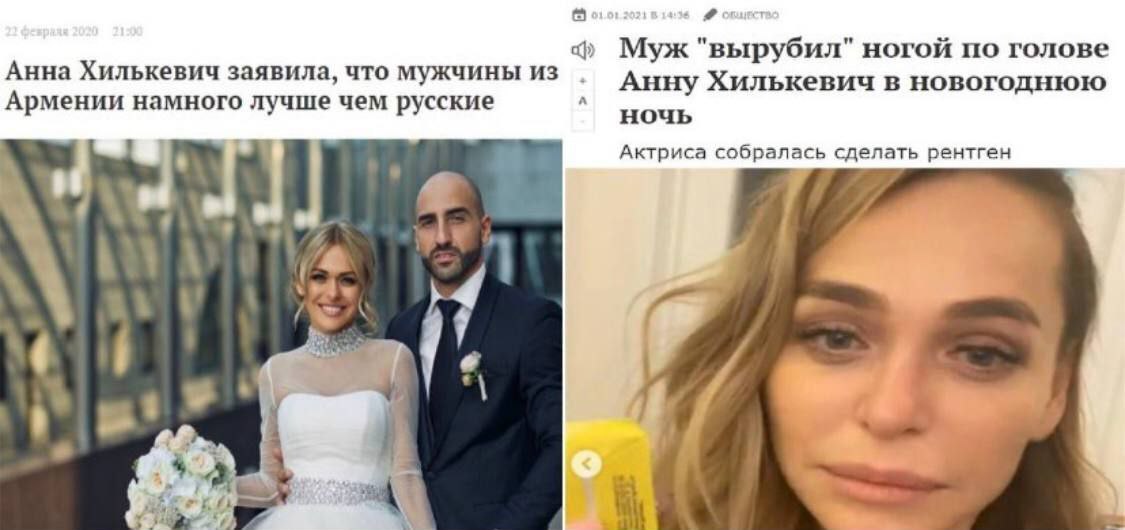 Муж "вырубил" ногой по голове Анна Хилькевич заявила, что мужчины из Анну Хилькевич в новогоднюю Армении намного лучше чем русские ночь Актриса собралась сделать рентген 4 54