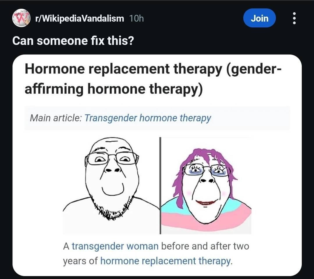 Join Can someone fix this? Hormone replacement therapy (gender- affirming hormone therapy) Main article: Transgender hormone therapy у A transgender woman before and after two years of hormone replace