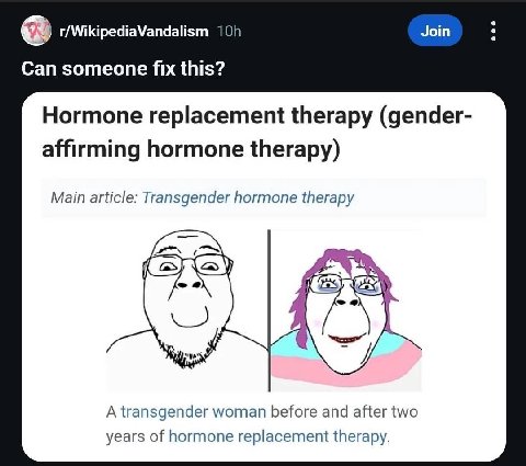 Join Can someone fix this? Hormone replacement therapy (gender- affirming hormone therapy) Main article: Transgender hormone therapy у A transgender woman before and after two years of hormone replace