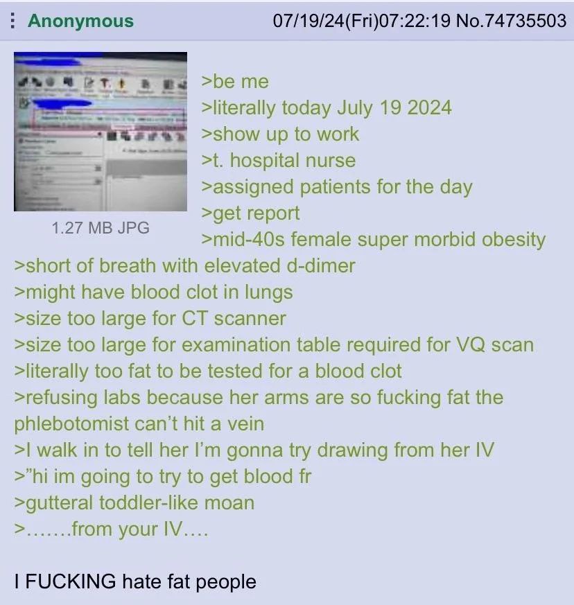 Anonymous 07/19/24(Fri)07:22:19 No.74735503 а вы >beme >literally today July 19 2024 >show up to work hospital nurse >assigned patients for the day 1 27 JPG >mid-40s female super morbid obesity >short